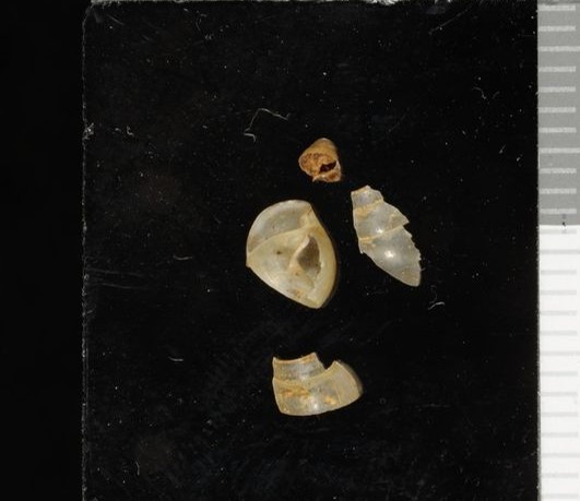 Fernandezia philippiana Pilsbry, 1911 Fernandezia philippiana Pilsbry, 1911